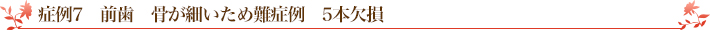 症例7　前歯　骨が細いため難症例　5本欠損