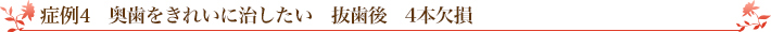 症例4　奥歯をきれいに治したい　抜歯後　4本欠損