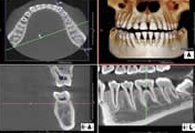 安心、信頼の歯科用CTを導入画像