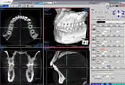 安心、信頼の歯科用CTを導入画像