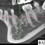 安心、信頼の歯科用CTを導入画像